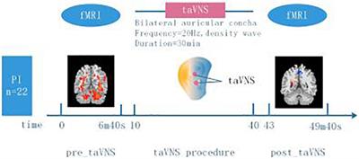 The Instant Spontaneous Neuronal Activity Modulation of Transcutaneous Auricular Vagus Nerve Stimulation on Patients With Primary Insomnia